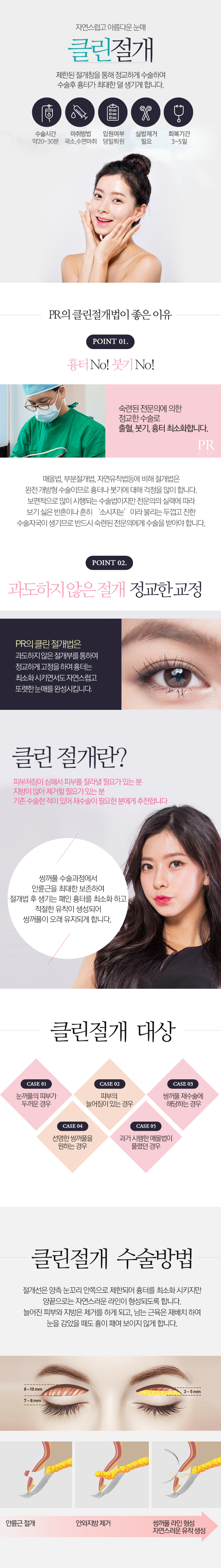 클린절개