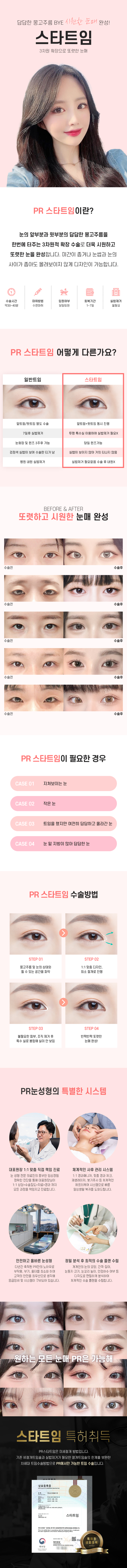 앞트임