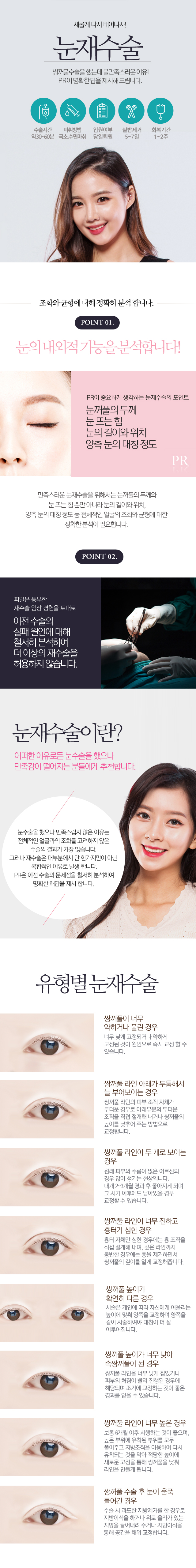 눈재수술