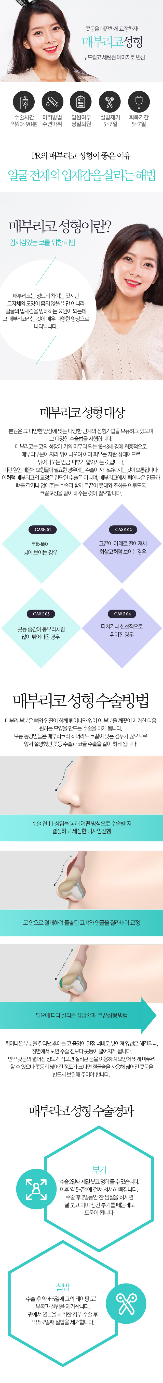 매부리코교정