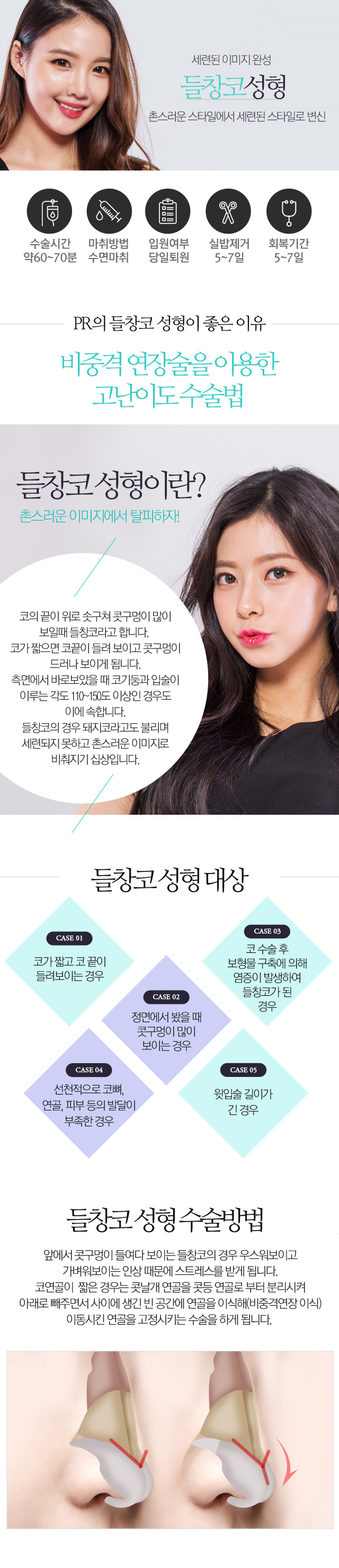 들창코(짧은코)