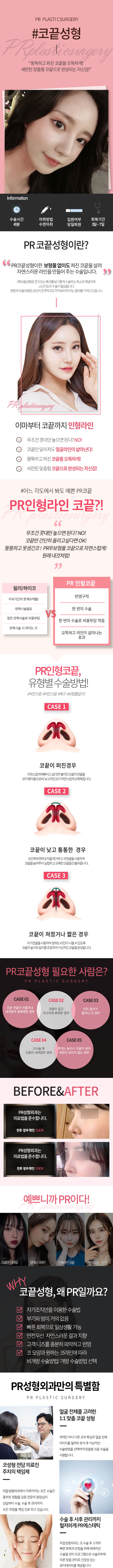 코끝성형