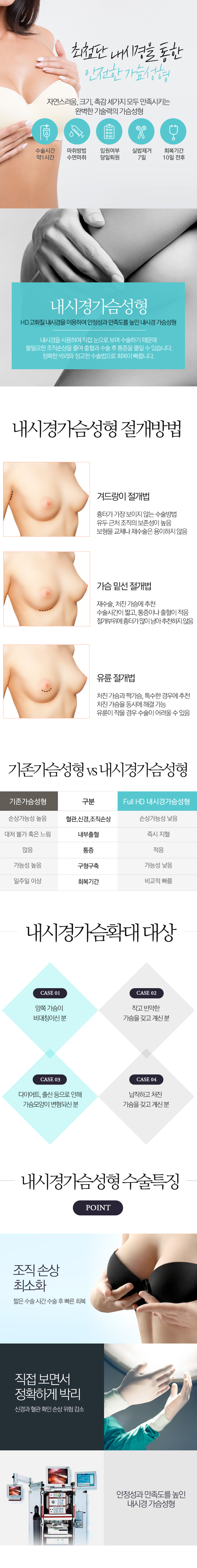 내시경 가슴확대술