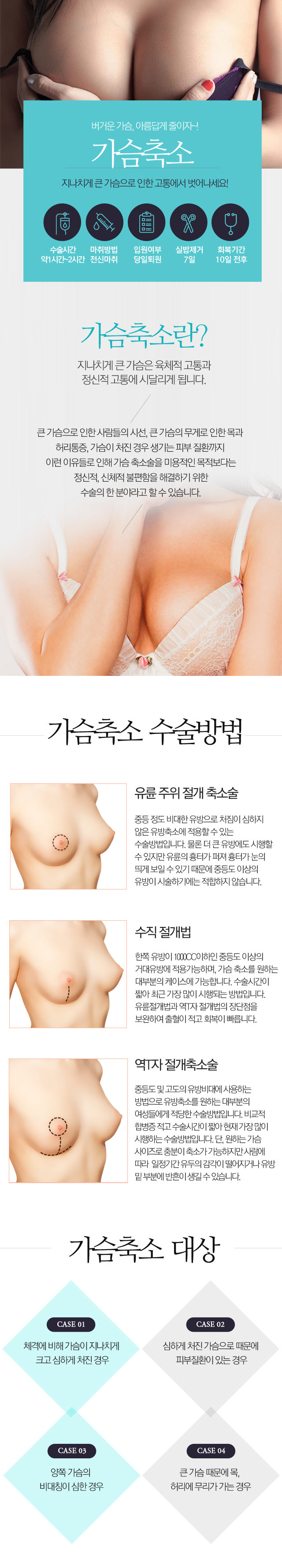 가슴축소술