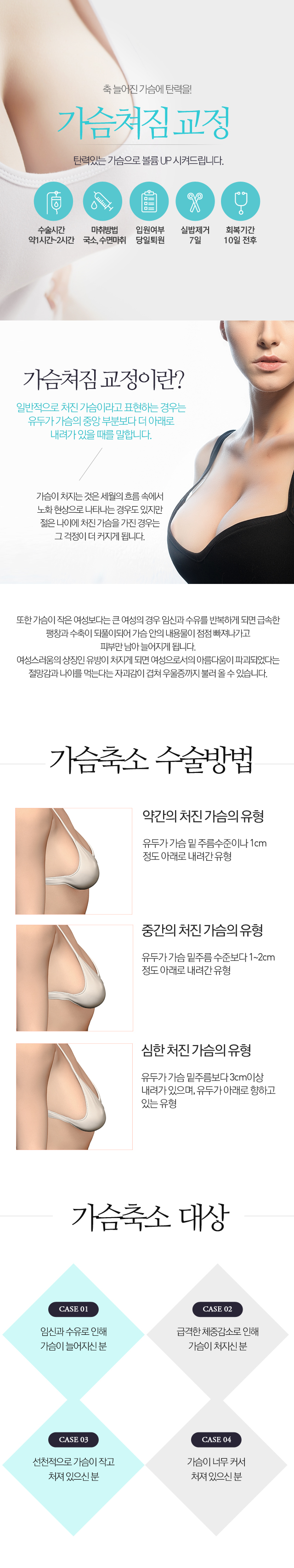 처진가슴 교정술