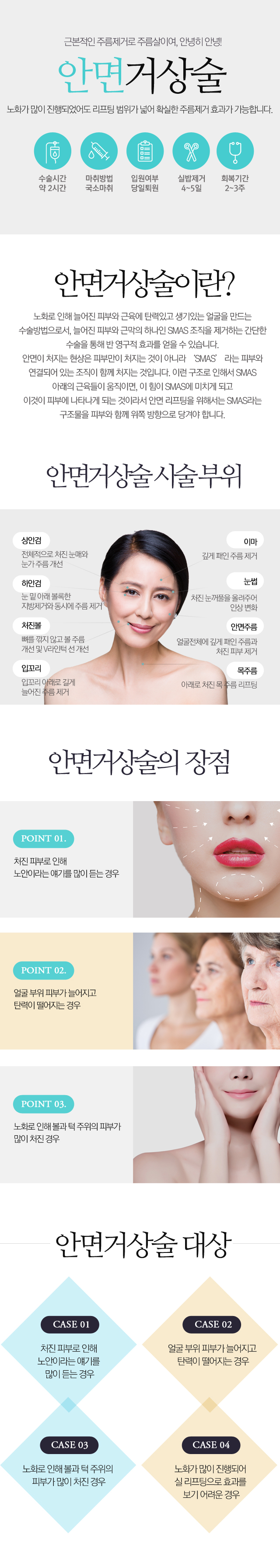 안면거상술