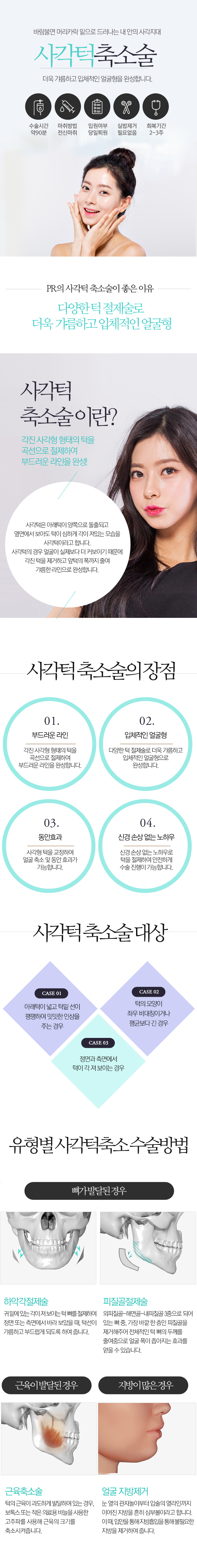 사각턱축소술