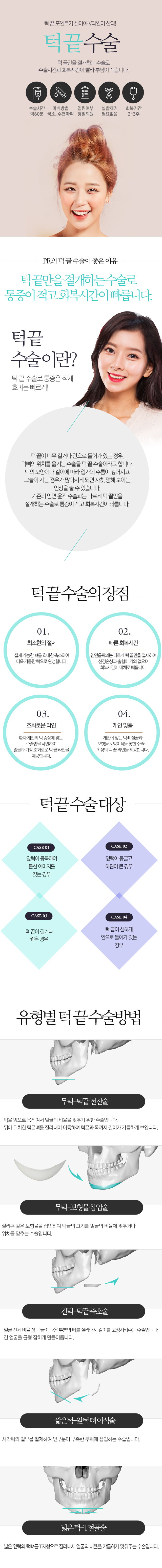 턱 끝 수술
