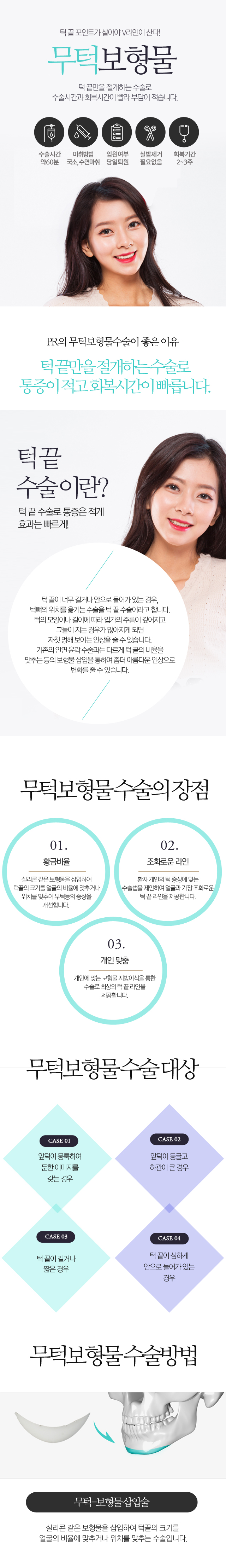 무턱보형물