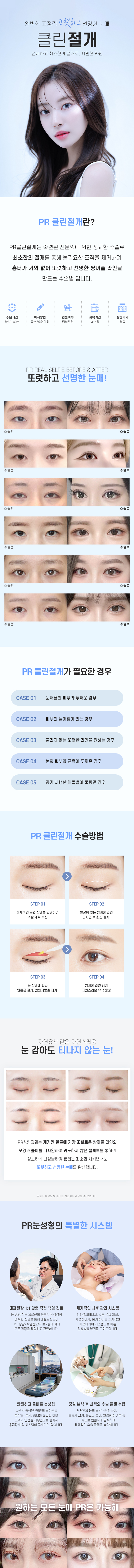 PR성형외과의특별함