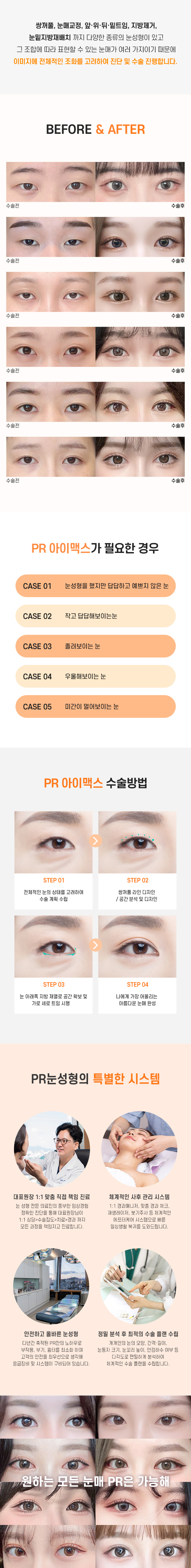 PR성형외과의특별함