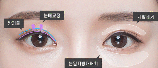 PR성형외과의특별함