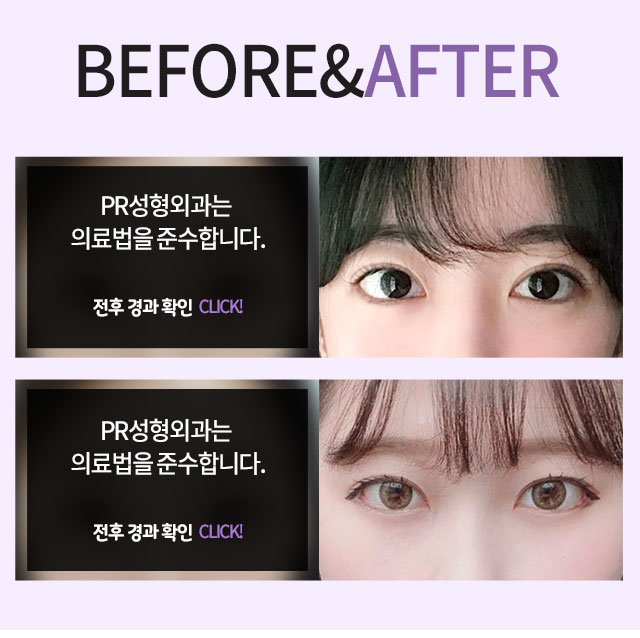 PR성형외과의특별함