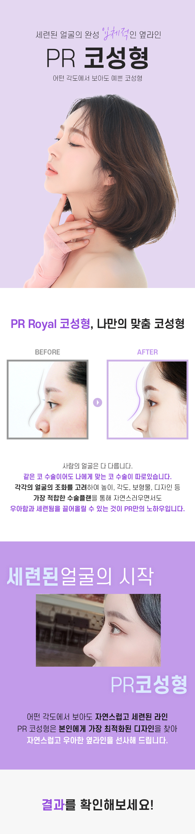 Royal Rhinoplasty