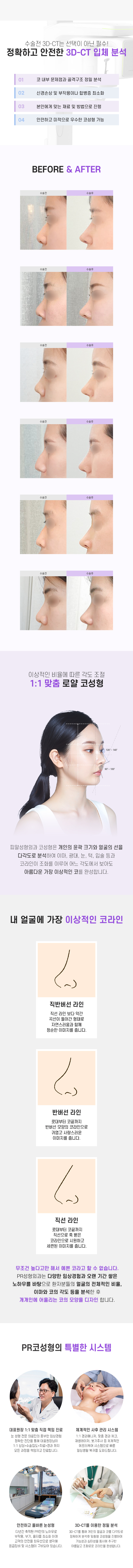 Royal Rhinoplasty 
