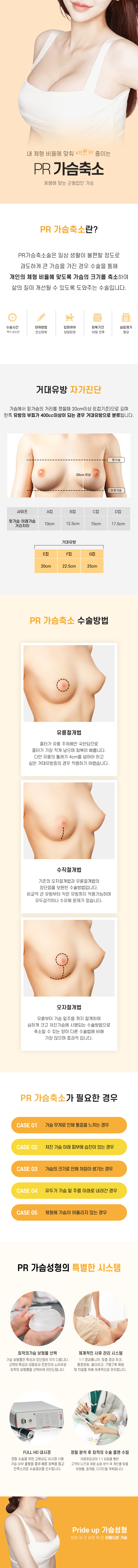 가슴축소술