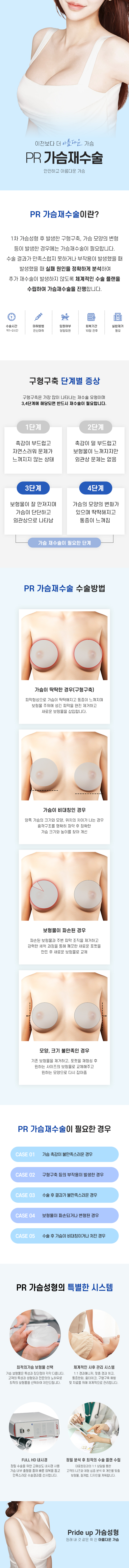 가슴축소술