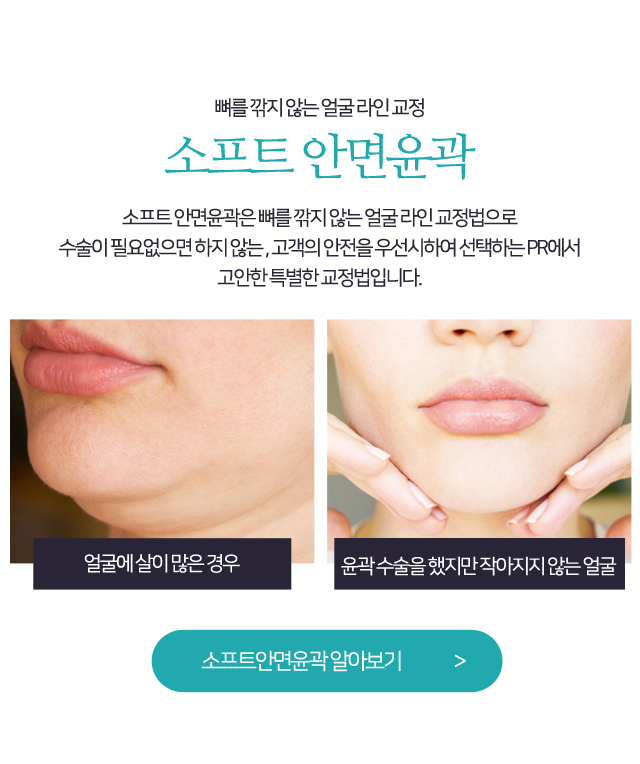 소프트안면윤곽